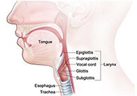 Laryngeal Cancer Treatment India