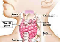 Thyroid Cancer Treatment India