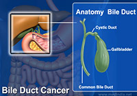 Bile Duct Cancer Treatment India