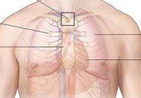 Chest Cancer Treatment India