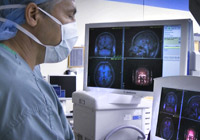 Advanced Epilepsy Surgery India