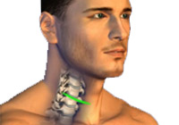 Anterior Cervical Discectomy and Fusion (ACDF) India