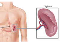 Laparoscopic for Splenectomy India